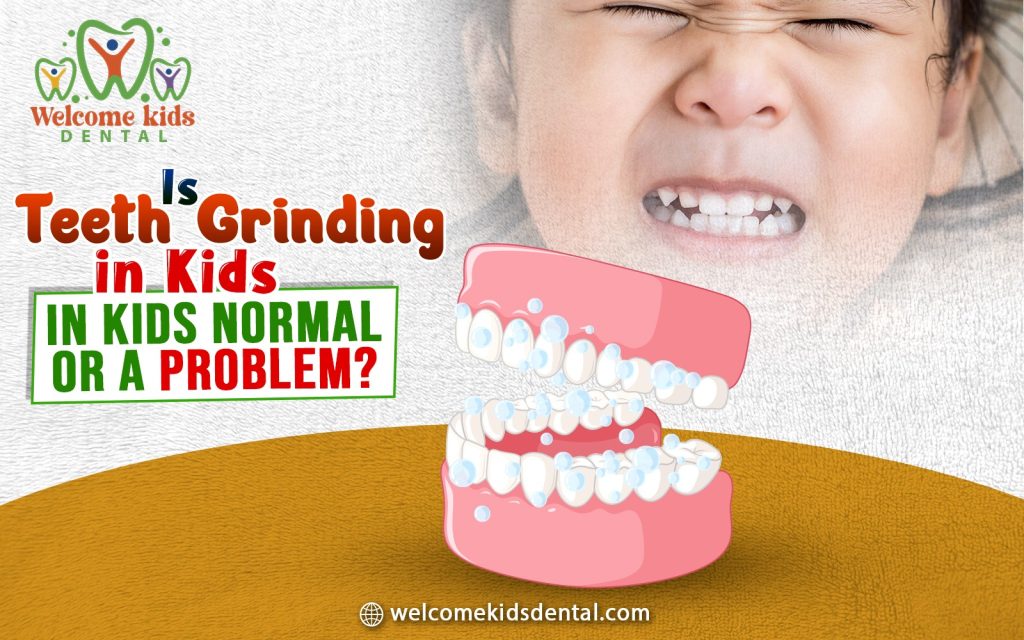 Is Teeth Grinding in Kids Normal or a Problem?