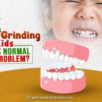 Thumbnail for Is Teeth Grinding in Kids Normal or a Problem?