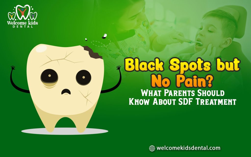 Black Spots but No Pain? What Parents Should Know About SDF Treatment