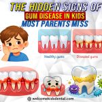 Thumbnail for The Hidden Signs of Gum Disease in Kids Most Parents Miss
