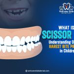 Thumbnail for What Is a Scissor Bite? Understanding One of the Rarest Bite Problems in Children