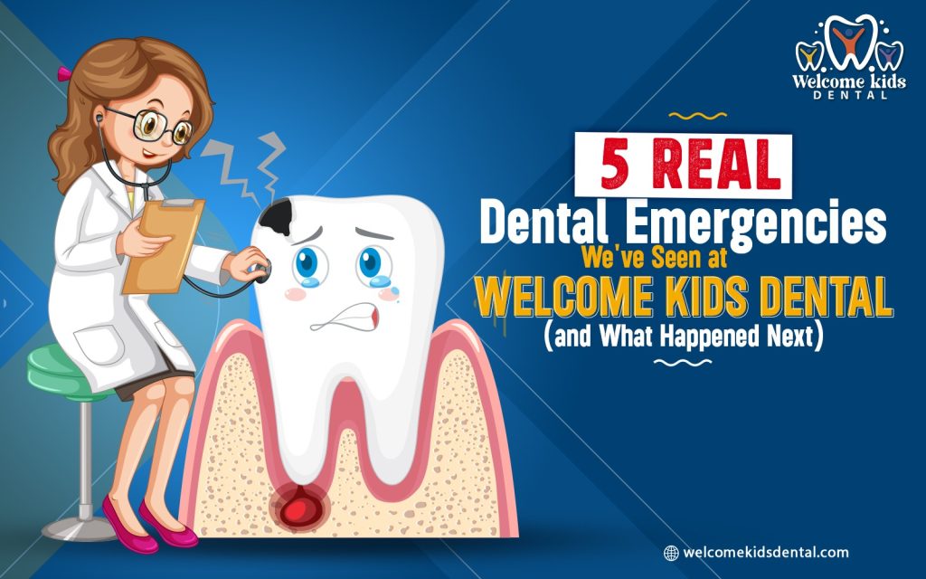 5 Real Dental Emergencies We’ve Seen at Welcome Kids Dental (and What Happened Next)