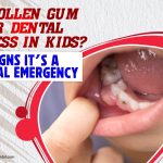Thumbnail for Swollen Gum or Dental Abscess in Kids? Signs It’s a Dental Emergency