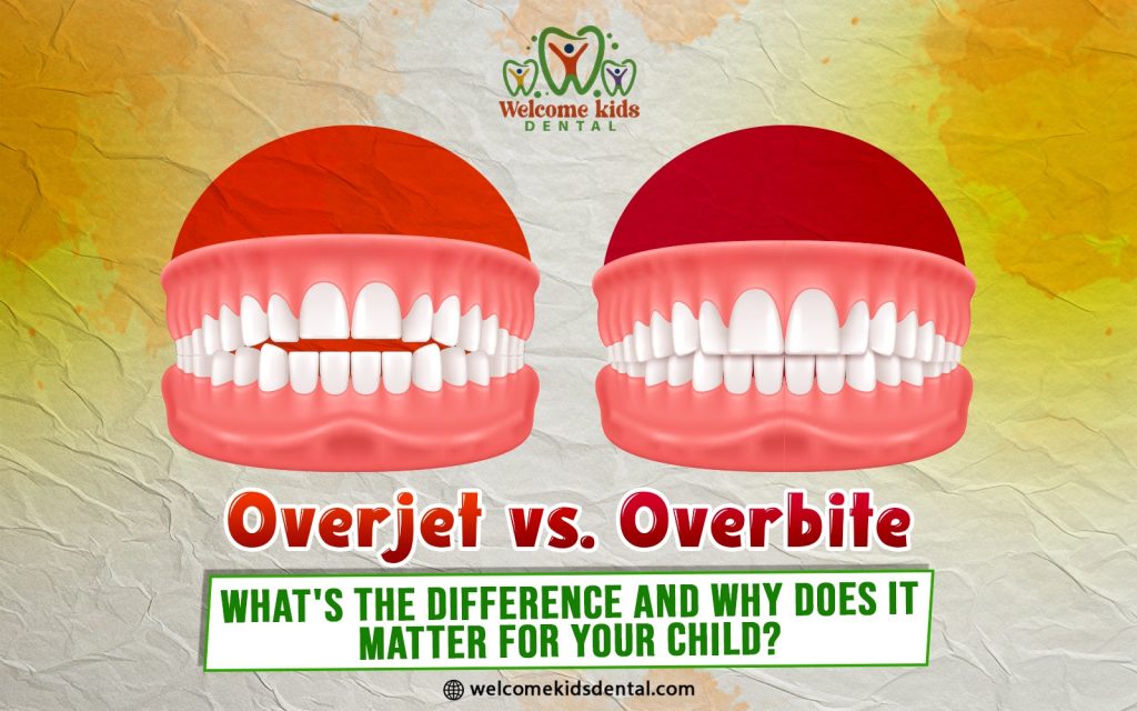 Overjet vs. Overbite: What’s the Difference and Why Does It Matter for Your Child?