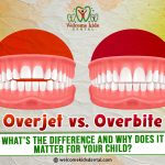 Thumbnail for Overjet vs. Overbite: What’s the Difference and Why Does It Matter for Your Child?