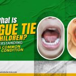 Thumbnail for What Is Tongue Tie in Children? Understanding This Common Oral Condition